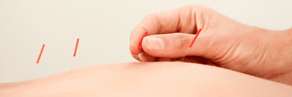 Acupuncture: just a placebo or something more?